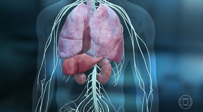 Transplante de fígado traz esperança para pacientes graves com falência múltipla